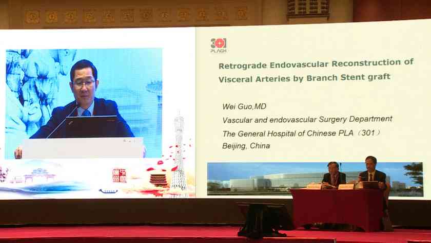 Wei Guo：Retrograde Endovascular Reconstruction of Visceral Arteries by Branch Stent graft